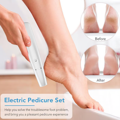 Extracteur de callosités électrique pour les pieds