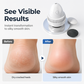 🔥‑50% PROMO FLASH🦶 Rasoir électrique professionnel pour callosités pieds, élimine peau dure, rend la peau douce sans effort ✨💆
